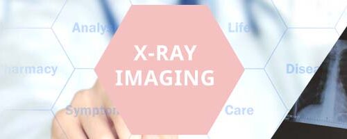 XRAY IMAGING roze